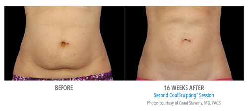 B&A-Stevens-AB-2Set-16wk-lowRes